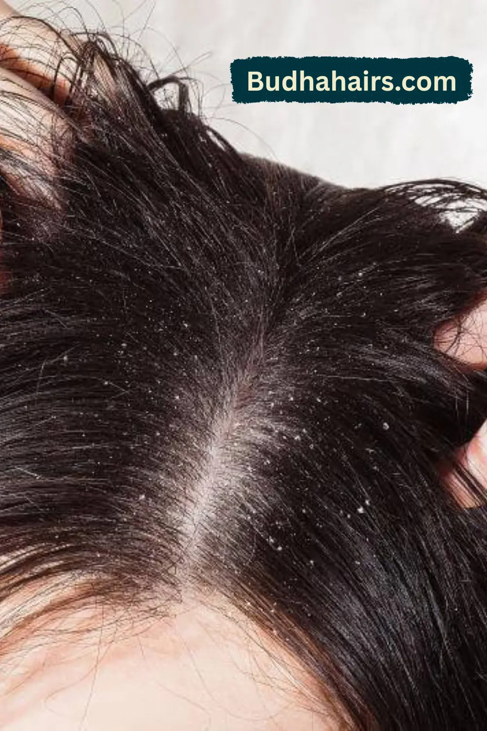 Balance Scalp Oil with an Apple Cider Vinegar Rinse